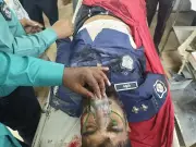 গাজীপুরে ট্রেনে কাটা পড়ে পুলিশ সদস্যের হাত-পা বিচ্ছিন্ন, হাসপাতালে ভর্তি