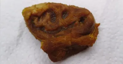 কালিয়াকৈরে গরুর মাংসে 'আল্লাহ' লেখা: স্থানীয়দের মধ্যে কৌতূহল ও চাঞ্চল্য