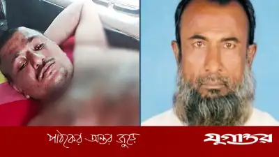 ফরিদপুরে বুদ্ধিপ্রতিবন্ধীকে গরম পানিতে ঝলসে দেওয়ার অভিযোগ, আওয়ামী লীগ নেতা আক্তার খালাসি জড়িত