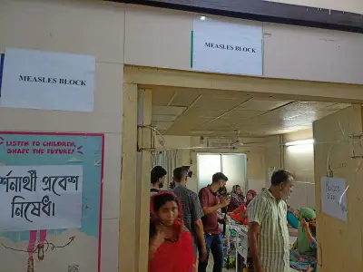 চট্টগ্রাম মেডিকেল কলেজ হাসপাতালে খোলা হয়েছে পৃথক হাম কর্নার, জেলায় ২৮ শিশু ভর্তি