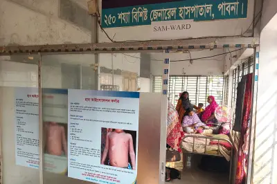 পাবনা জেনারেল হাসপাতালে হামে আক্রান্ত রোগীর সংখ্যা উদ্বেগজনক হারে বৃদ্ধি পাচ্ছে