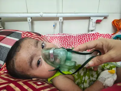 ময়মনসিংহ মেডিকেলে হামে আরও ২৭ শিশু ভর্তি, ১০ মাস বয়সী শিশুর মৃত্যু