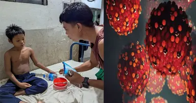 কুরুকপাতায় হামে ৪ শিশুর মৃত্যু, জরুরি মেডিকেল ক্যাম্পের দাবি