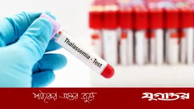 থ্যালাসেমিয়া: ভবিষ্যৎ প্রজন্মের জন্য বড় হুমকি, প্রতিরোধে করণীয়