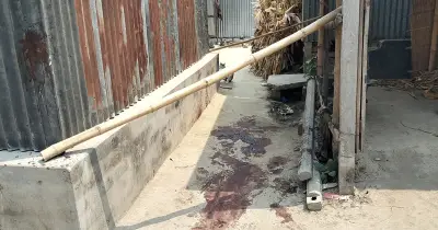 ফরিদপুরে হাত-পা বিচ্ছিন্নের ঘটনায় মামলা, আশঙ্কাজনক অবস্থায় ভাইরা