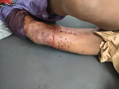 চট্টগ্রামে সন্ত্রাসীদের গুলিতে আহত চারজন, পুলিশ পাঁচজন আটক