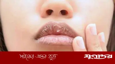 গ্রীষ্মকালেও ঠোঁট ফাটার সমস্যা: বিশেষ যত্নের সহজ উপায়