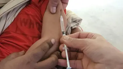 শিশুদের হাম ও জলবসন্ত: টিকার গুরুত্ব, লক্ষণ ও প্রতিরোধ ব্যবস্থা