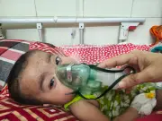 ময়মনসিংহে হামের প্রাদুর্ভাব: ২৪ ঘণ্টায় ২১ শিশু ভর্তি, মোট আক্রান্ত ১৪৩