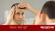 ডিএইচটি হেয়ার লস: চুল পড়ার জেনেটিক কারণ ও সমাধান