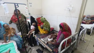 হামের প্রকোপে হাসপাতালে শিশুদের ভীড়, শয্যা সংকট চরমে