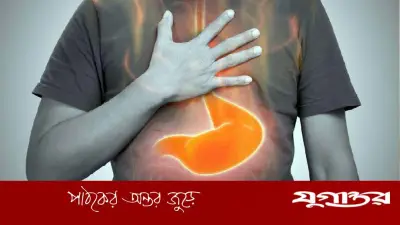 গরমে হালকা খাবারেও পেট ভার? ৫ ভুলে বাড়ে গ্যাস-অম্বল