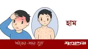 ময়মনসিংহে ২৪ ঘণ্টায় হামে আরও ২ শিশুর মৃত্যু, মৃতের সংখ্যা ৩১