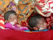 রাজশাহীতে দুই জমজ শিশুর শরীরে অ্যান্টিবায়োটিকের কার্যকারিতা হারানোর আশঙ্কা