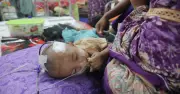 হামের প্রাদুর্ভাবে মৃতের সংখ্যা বেড়ে ৪৫৩, ২৪ ঘণ্টায় নতুন ২ মৃত্যু