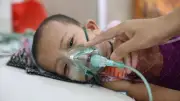 হটস্পট ৩০ উপজেলায় কমেছে হাম সংক্রমণ