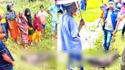 সিরাজগঞ্জে একদিনে হামে আক্রান্ত ৪২ জন, উদ্বেগ বাড়ছে