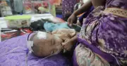 হামের প্রাদুর্ভাবে শিশুদের মৃত্যু: ব্যর্থতার এক কালো অধ্যায়