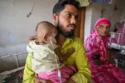 হামের পর জটিলতা: শিশুর রোগ প্রতিরোধক্ষমতা ভেঙে যায়, বাড়ে মৃত্যুঝুঁকি