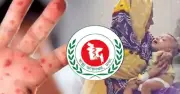 হামে আরও চার শিশুর মৃত্যু, সিলেটে মৃতের সংখ্যা ৪০