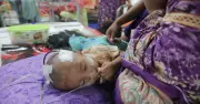 মিজলসে ৫২৮ শিশুর মৃত্যু: স্বাস্থ্য ব্যবস্থার ব্যর্থতা
