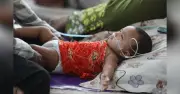 আরও ৮ শিশুর মৃত্যু, হামে মৃতের সংখ্যা ৫৮৩