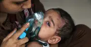 ২৪ ঘণ্টায় হামে আরও ৪ শিশুর মৃত্যু, মৃতের সংখ্যা ২৩৫