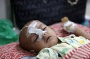 হাম ও উপসর্গে গত ২৪ ঘণ্টায় আরও ১০ শিশুর মৃত্যু