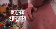 শিশুকে হাম থেকে বাঁচাতে টিকা দিন, জানুন বিস্তারিত