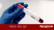 বিয়ের আগে রক্ত পরীক্ষা বাধ্যতামূলক করার আইন চান মন্ত্রী