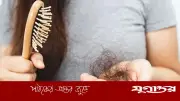 চুল পড়া রোধে কার্যকরী ৫টি খাবার