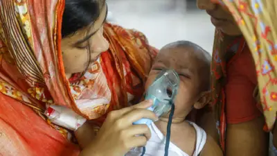 মিজলসের লক্ষণে আরও ৭ শিশুর মৃত্যু