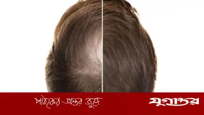 প্রাচীন চীনা ভেষজে পুনরায় গজাবে চুল, বলছে গবেষণা