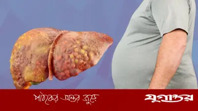ওজন না কমার পেছনে লিভারের গোপন রোগ ফ্যাটি লিভার