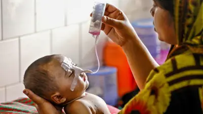 হামে মৃতের সংখ্যা বেড়ে ৭১২, নতুন করে ৯৪১ সন্দেহভাজন রোগী শনাক্ত