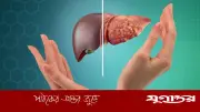 চোখের ৫ লক্ষণে ফ্যাটি লিভার চিনুন, সতর্ক হোন এখনই