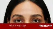 চোখের নিচে কালি পড়ার ৫ কারণ: শুধু ঘুমের অভাব নয়