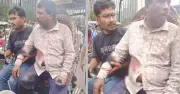 মতিঝিলে প্রকাশ্যে ব্যবসায়ীকে গুলি করে ডলার ছিনতাই, মামলা হয়নি