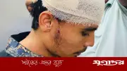 উত্ত্যক্তের প্রতিবাদ করায় কলেজছাত্রের ওপর হামলা, মাথায় গুরুতর জখম