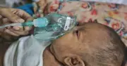 ২৪ ঘণ্টায় হামে আরও ৪ শিশুর মৃত্যু, আক্রান্ত ১১২৭