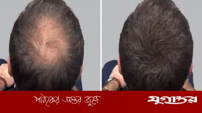 নতুন চুল গজাতে মেথির পানিতে যোগ করুন ৪ ভেষজ