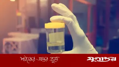 প্রস্রাবের রঙ কি সব রোগের ইঙ্গিত দেয়? চিকিৎসকের মতামত