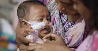 ২৪ ঘণ্টায় হামে আরও ৫ শিশুর মৃত্যু, মোট মৃত ৭৫৮