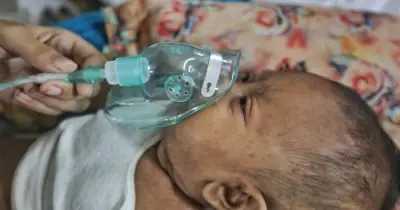 ২৪ ঘণ্টায় হামে আরও ৩ শিশুর মৃত্যু, মৃতের সংখ্যা ৭৪১