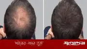 নতুন চুল গজাতে মেথির পানিতে যোগ করুন ৪ ভেষজ
