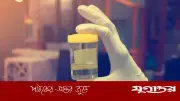 প্রস্রাবের রঙ কি সব রোগের ইঙ্গিত দেয়? চিকিৎসকের মতামত