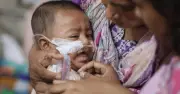 ২৪ ঘণ্টায় হামে আরও ৫ শিশুর মৃত্যু, মোট মৃত ৭৫৮
