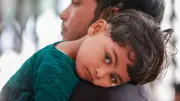 হাম ও জলবসন্তে শিশুদের পুষ্টি ব্যবস্থাপনা: বিশেষজ্ঞের পরামর্শ