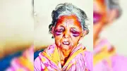চিকিৎসকদের গ্রামমুখী হওয়ার আহ্বান প্রধানমন্ত্রীর, যোগদানের পরই উধাও চিকিৎসক