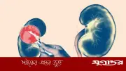 কিডনির সবচেয়ে বড় শত্রু যে তিনটি বিষয়